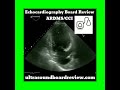 Echocardiography