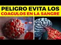 ¡ALERTA! Por Esta Razón Te Salen COÁGULOS EN LA SANGRE, , no lo hagas tu cerebro te lo agradecerá