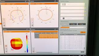 TRP & TIS test