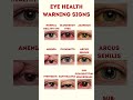 Eye Health Warning Signs
