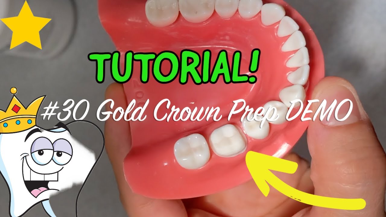 30 GOLD Crown Prep DEMO on Typodont DENTISTRY MADE EASY YouTube