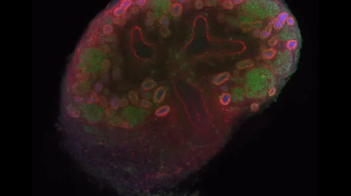 Z-stack through mouse kidney expressing activated ...