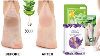 Foot Peeling Mask, but Does it Work? screenshot 5