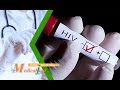 Анализы на ВИЧ (СПИД): через сколько времени и какие анализы крови сдать?