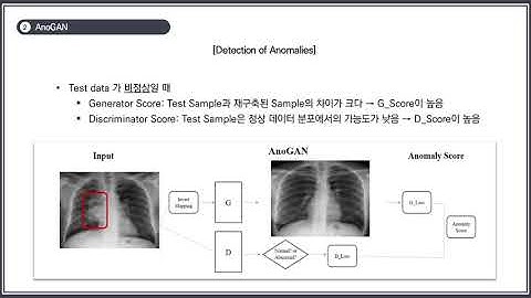 [Paper Review]Unsupervised Anomaly Detection with GAN to Guide Marker Discovery