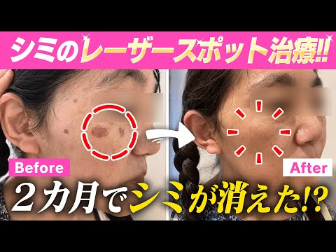 シミの治療 このシミをどう治す?第2版 Amazon.co.jp: シミの治療: このシミをどう治す? : 葛西健一郎: 本