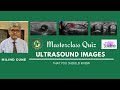 Masterclass ultrasound quiz  milind gune  10 images u should know  tuberculosis to trigger finger