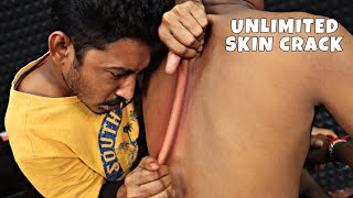 Unlimited Skin Cracking | Head Massage & neck Cracking | Hair Cracking | Body Massage | ASMR Massage