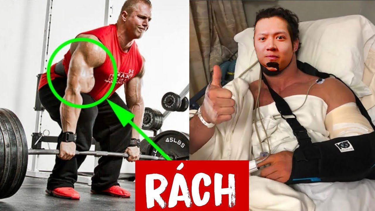 Seri Thứ 3 Kĩ thuật Mixed Grip và các vấn đề về MẤT CÂN BẰNG (Muscle