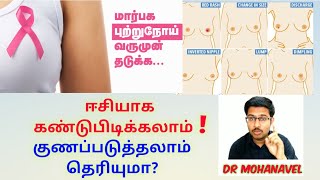 Breast cancer-KILLER Of Women-Symptoms-How to avoid-
Dr MOHANAVEL-Tamil