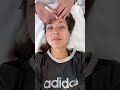 My new favourite procedure 🤩