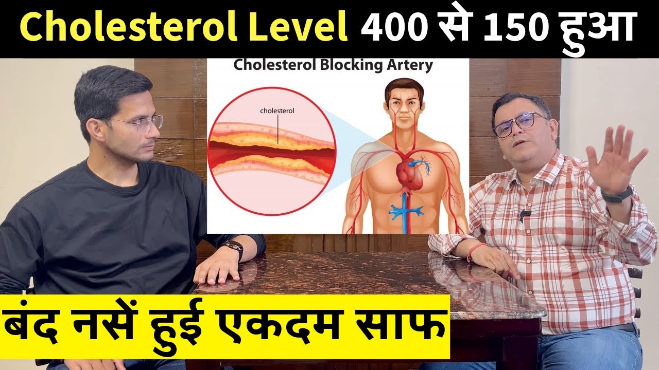 Control Cholesterol Ft. 
