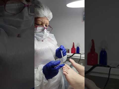 Vídeo: Dicloran Plus: Instrucciones Para El Uso Del Gel, Precio, Revisiones, Análogos