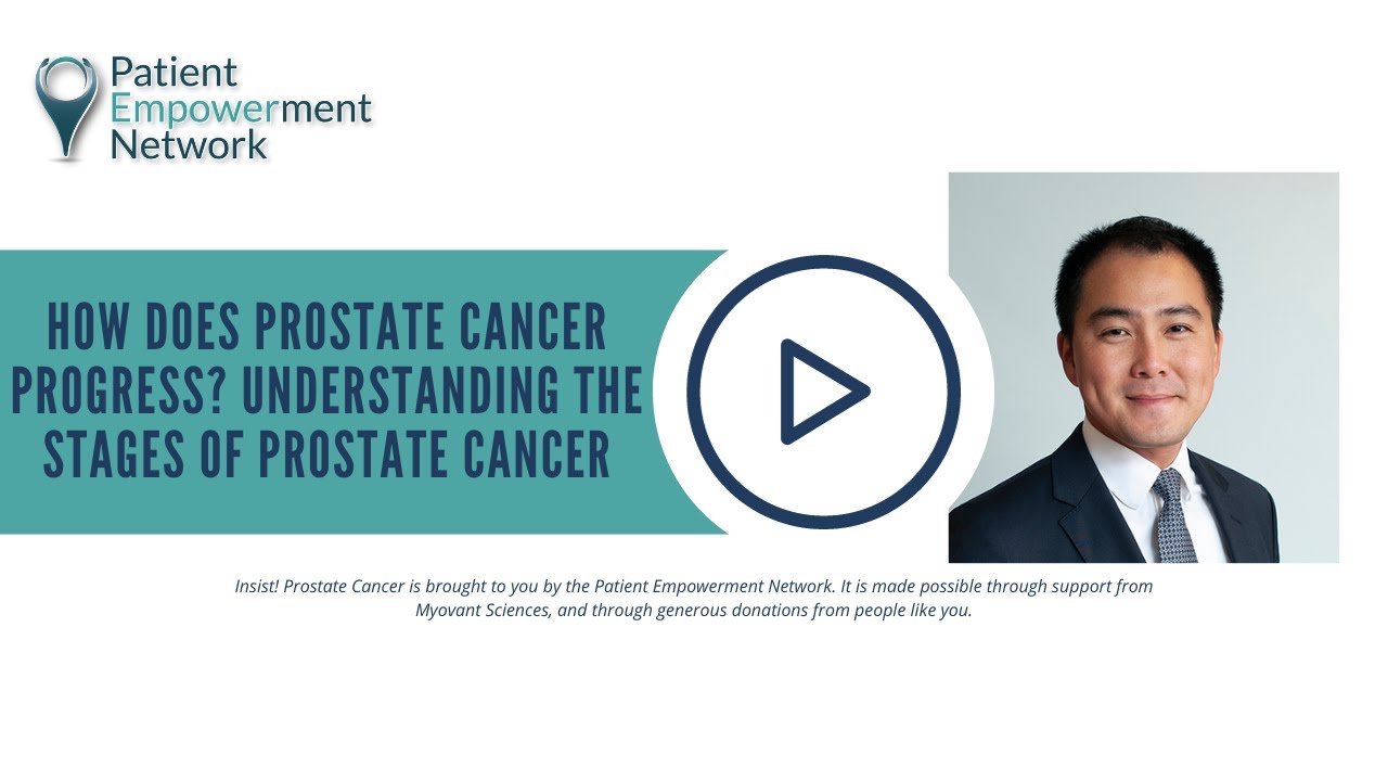 How Does Prostate Cancer Progress? Understanding the Stages of Prostate ...