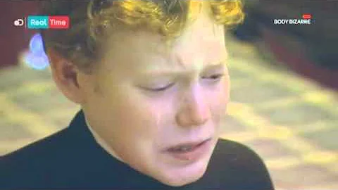 Cosa è il pemfigo bolloso?