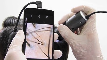 Dino Lite Applications  Dermatology