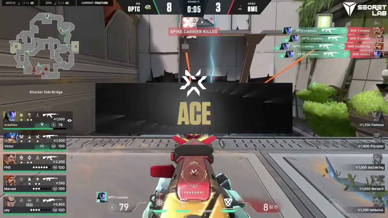 FRACTURE ROPE ACE IN VCT