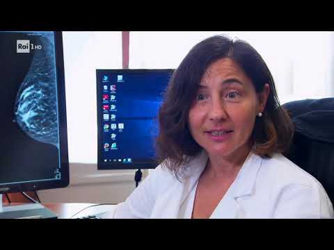 Video: Mammografia 3D: Costo, Risultati E Altro