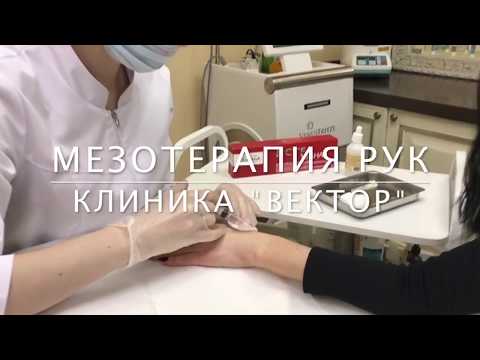 МЕЗОТЕРАПИЯ РУК - в клинике "ВЕКТОР"