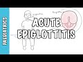 Acute Epiglottitis - signs and symptoms, causes, pathophysiology, treatment