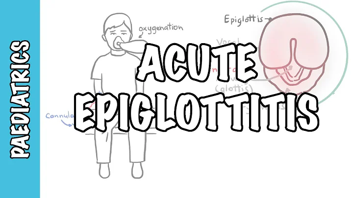 Acute Epiglottitis - signs and symptoms, causes, pathophysiology, treatment