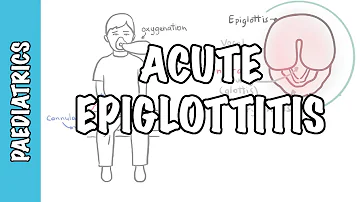 How common is epiglottitis in adults?