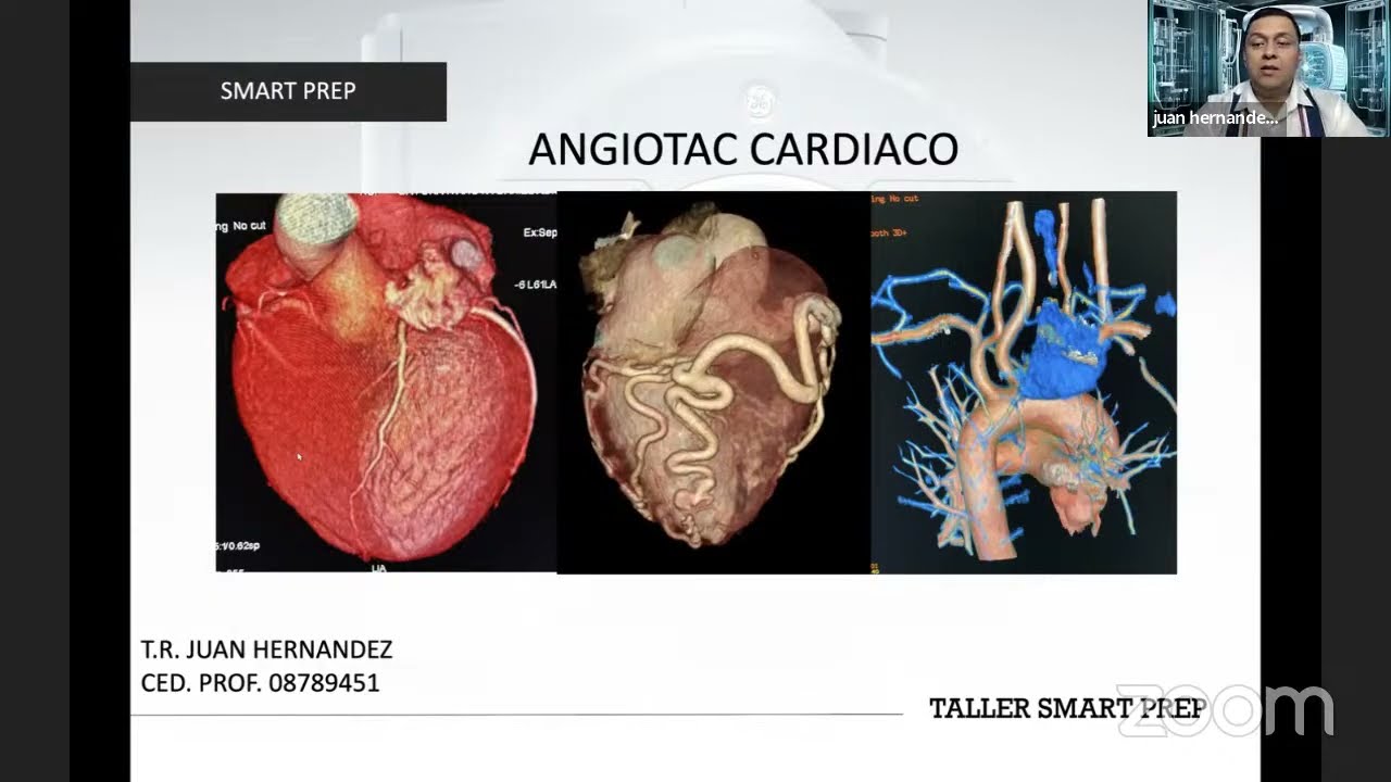 SMART PREP GENERAL ELECTRIC TR JUAN HERNANDEZ