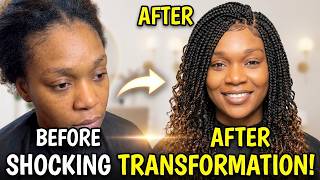 How to HIDE THIN EDGES with Crochet Braids | Gentle Technique