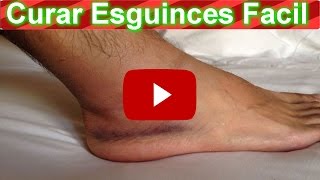 Los alrededor tobillos? deshacerse ¿Cómo del de líquido