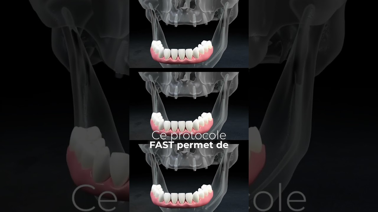 Prise en charge du patient &eacute;dent&eacute;