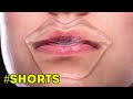 GIRLY BEAUTY HACKS || Treatments For Better Skin #shorts