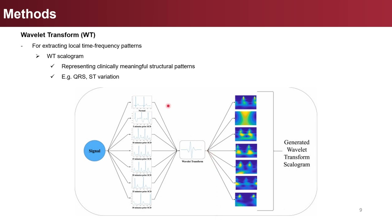 Early prediction of sudden cardiac death using multimodal fusion of ECG Features