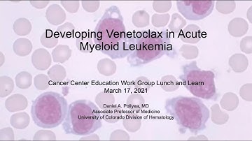 Developing Venetoclax in Acute Myeloid Leukemia