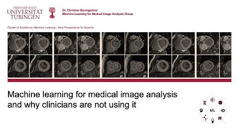 C. Baumgartner: Machine learning for medical image analysis and why clinicians are not using it