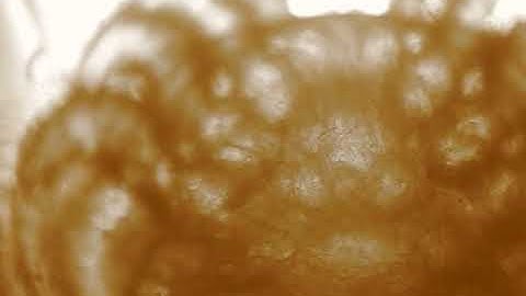 Video 1 Varroa Heart Systematic and Applied Acarology