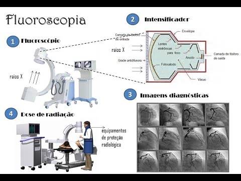 Vídeo: É Possível Fazer Fluorografia Durante A Lactação