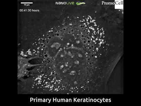 Video: Ovatko solut orvaskessä?