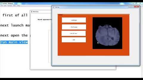 Brain Tumor Segmentation Magnetic Resonance Imaging Modality Matlab Projects