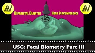 Fetal Biometry Part III BPD HC
