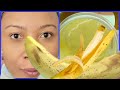 YOU WILL NEVER THROW AWAY BANANA PEELS AFTER WATCHING THIS