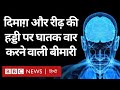 Rare Disease: Multiple sclerosis की रोकथाम क्या जल्द ही संभव होगी? Duniya Jahan (BBC Hindi)