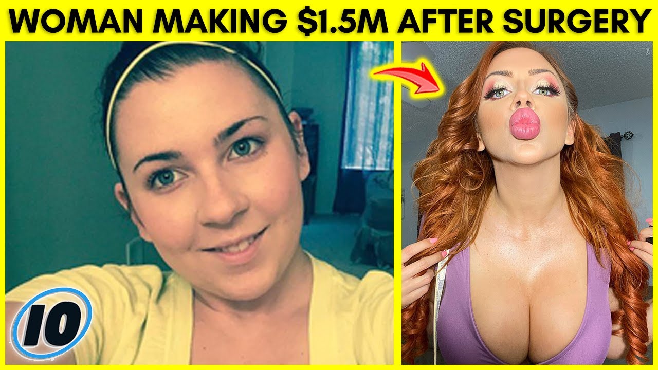 Woman Makes $1.5 Million A Year After Cosmetic Surgery