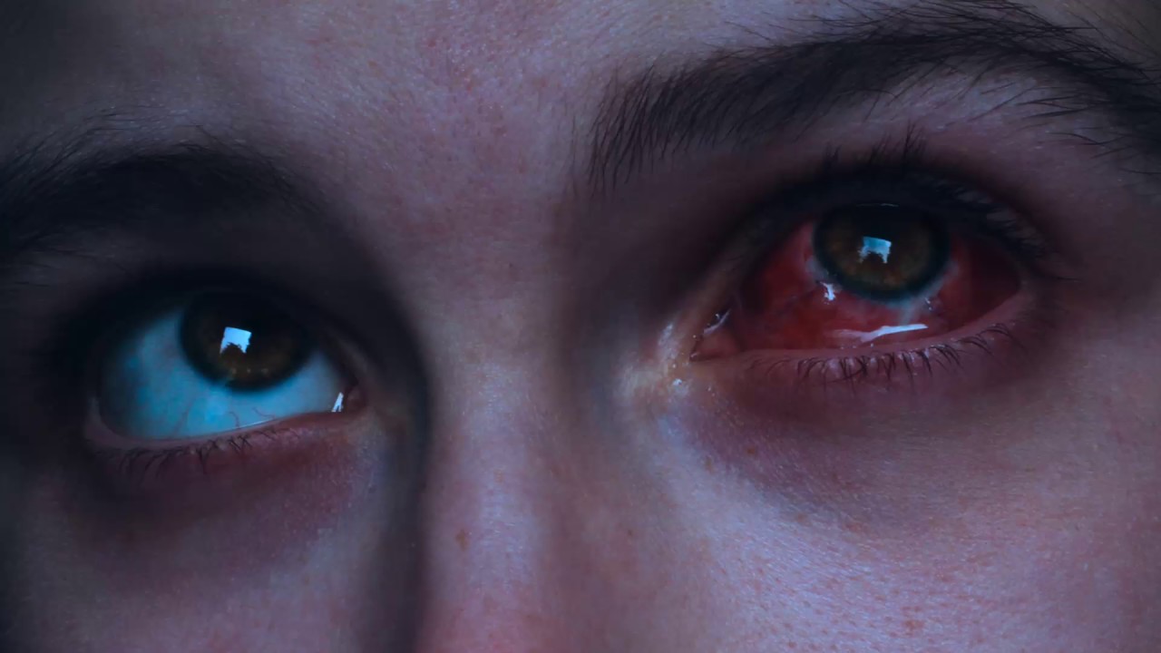 skeler - ＴＯ ＤＩＥ ＷＩＴＨＯＵＴ ＳＣＡＲＳ