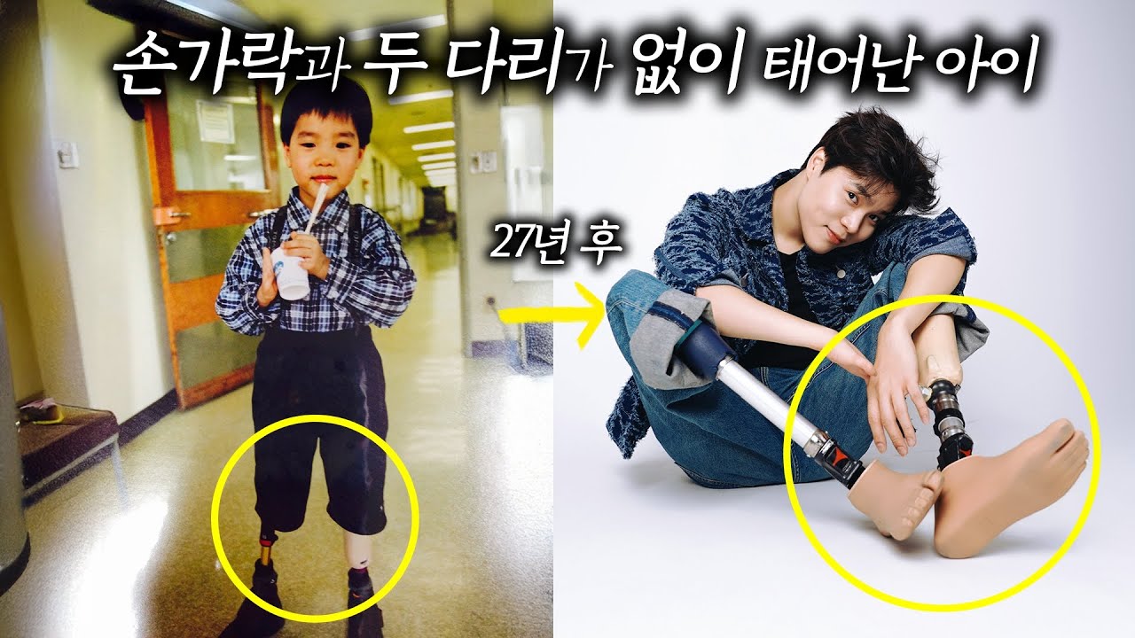 내가 죽음 대신 삶을 선택한 이유