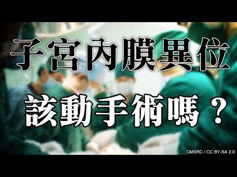 子宮內膜異位症，該動手術嗎？【不孕症成因】