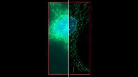 Huygens Widefield Deconvolution