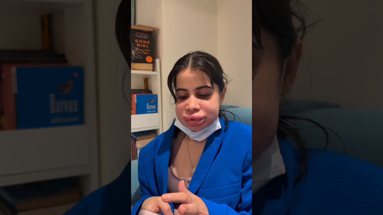 Uorfi's face surgery gone wrong 😱😱💔🥀😢😢💔🥀