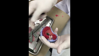 CD try in bite block 6/10