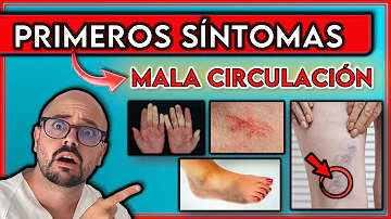 ¿Cuáles son los primeros signos de mala circulación?