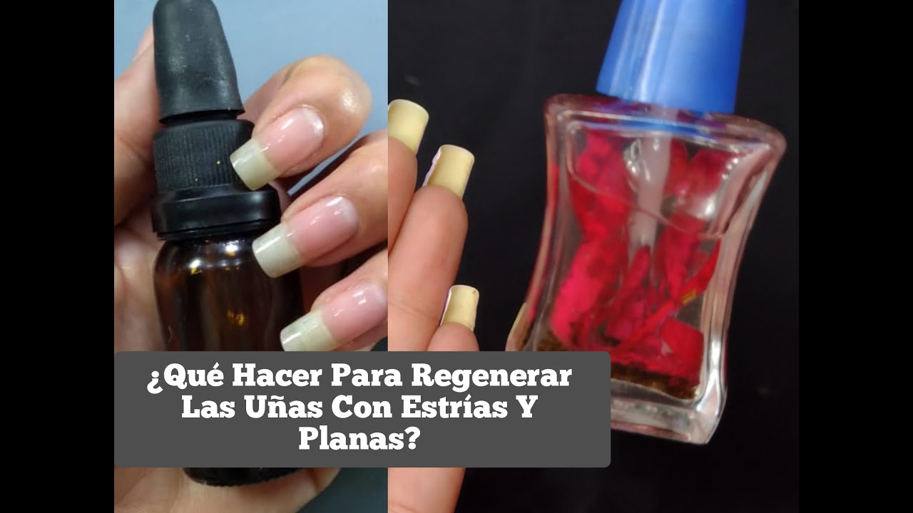 ¿ QUÉ HACER PARA REGENERAR LAS UÑAS CON ESTRÍAS Y PLANAS ?